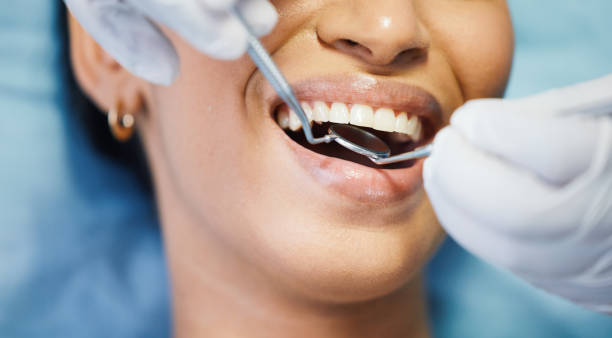 Best Emergency Dental Care for Broken or Chipped Teeth in North Logan, UT